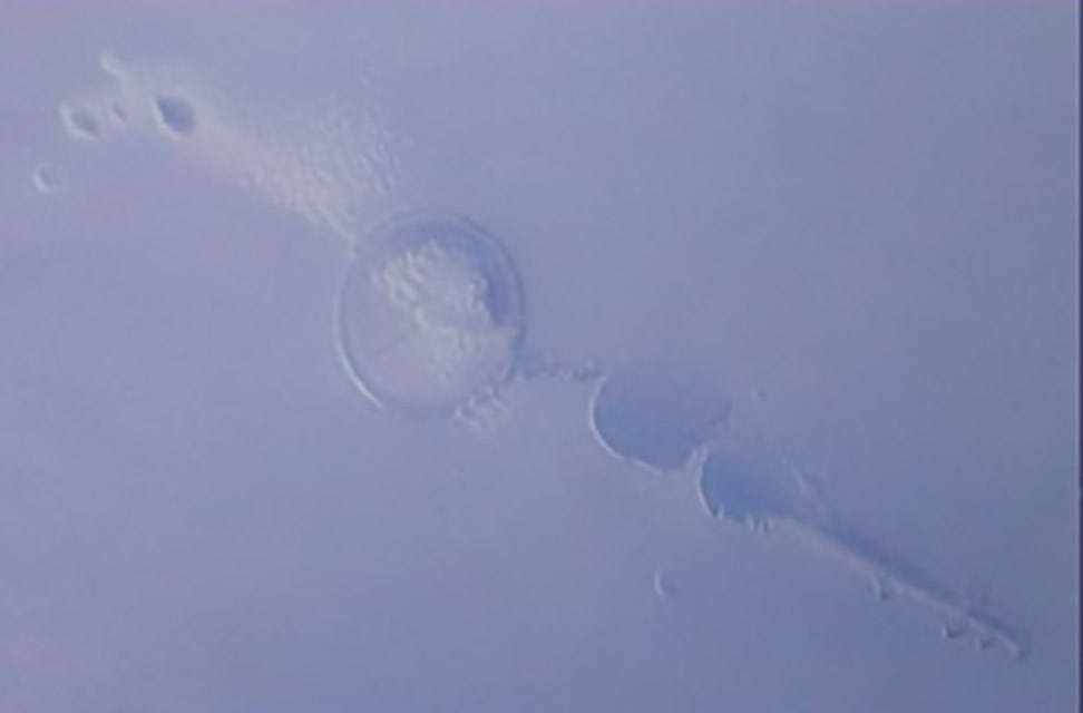 360-1-困气：注塑时带入空气